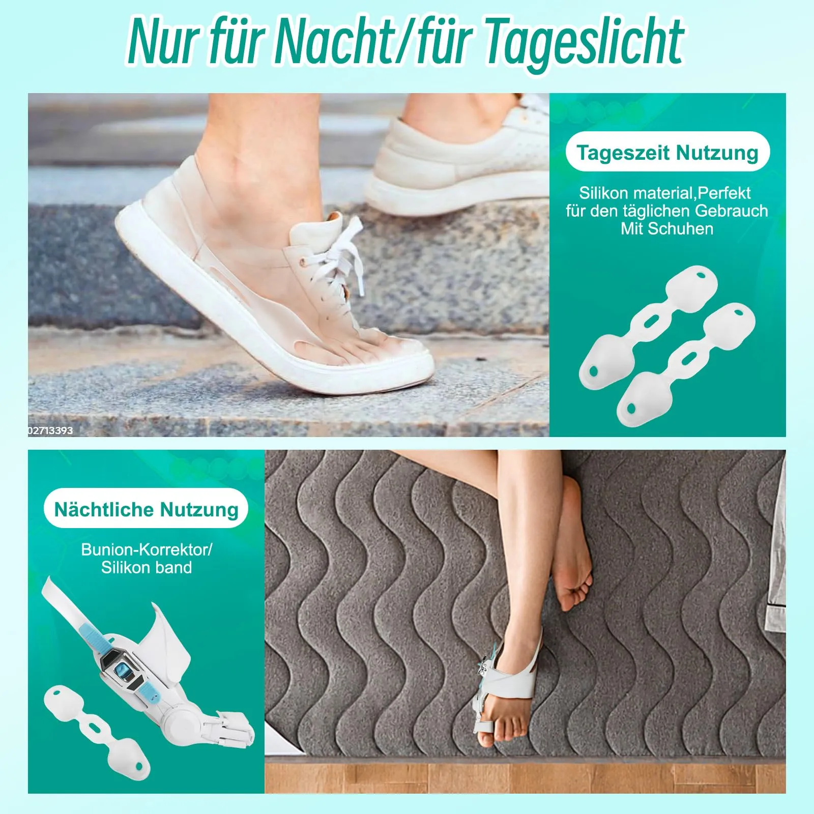 AESBELTA Hallux Valgus correction